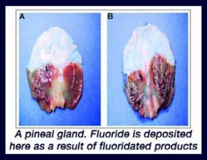 dangers of fluoride